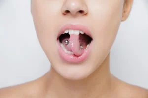 Body piercing